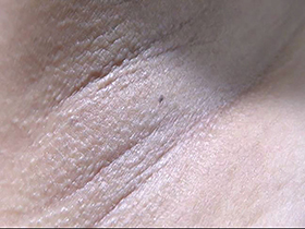 300人の腋 2　サンプル画像17